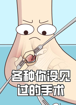 各种你没见过的手术